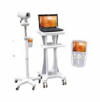 Máy soi cổ tử cung BT 2000 - Đức